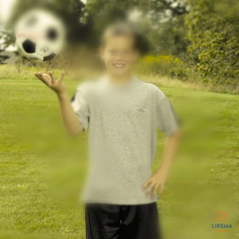 Katarakta - vaizdas kaip per rūką