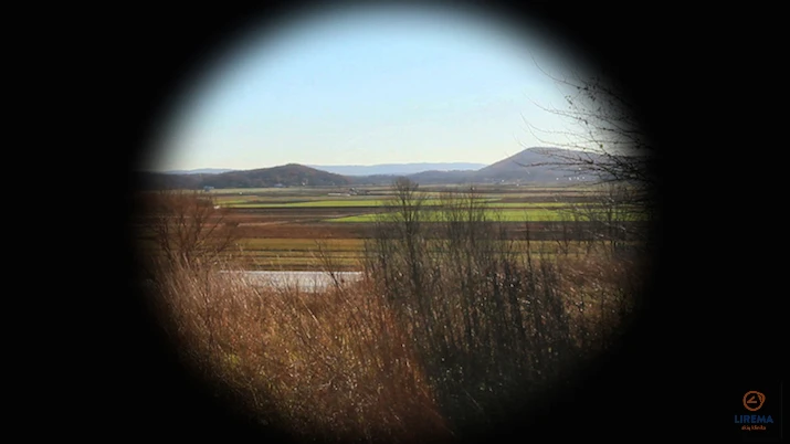 Akiu-klinika-lirema-glaukoma-3