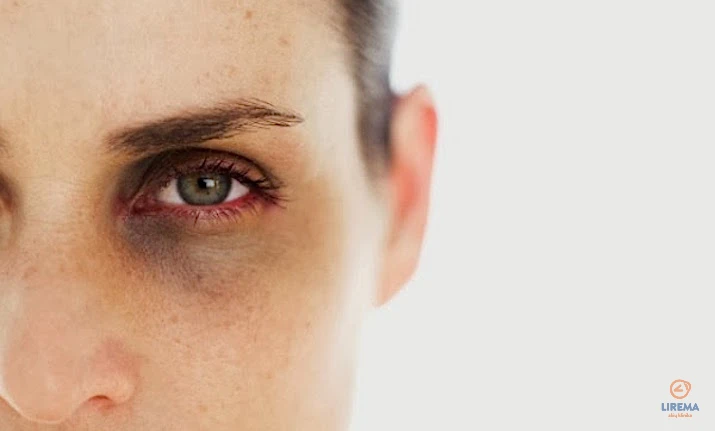 Akiu-klinika-Lirema-akiu-trynimas-3