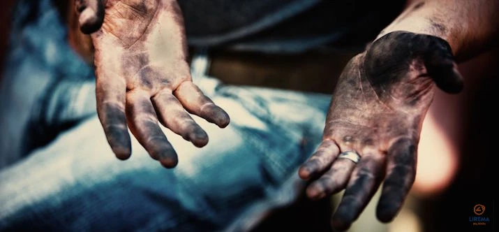 Akiu-klinika-Lirema-akiu-trynimas-4